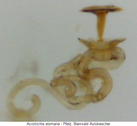 acrotrichis_atomaria_sperm2.jpg