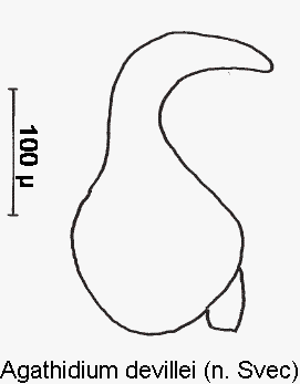 agathidium_devillei_sperm.gif