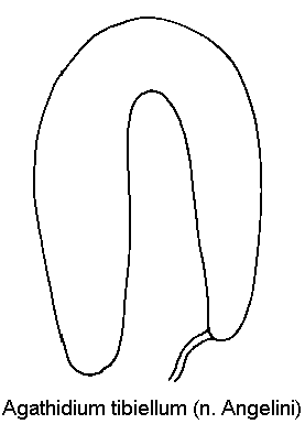 agathidium_tibiellum_sperm.gif