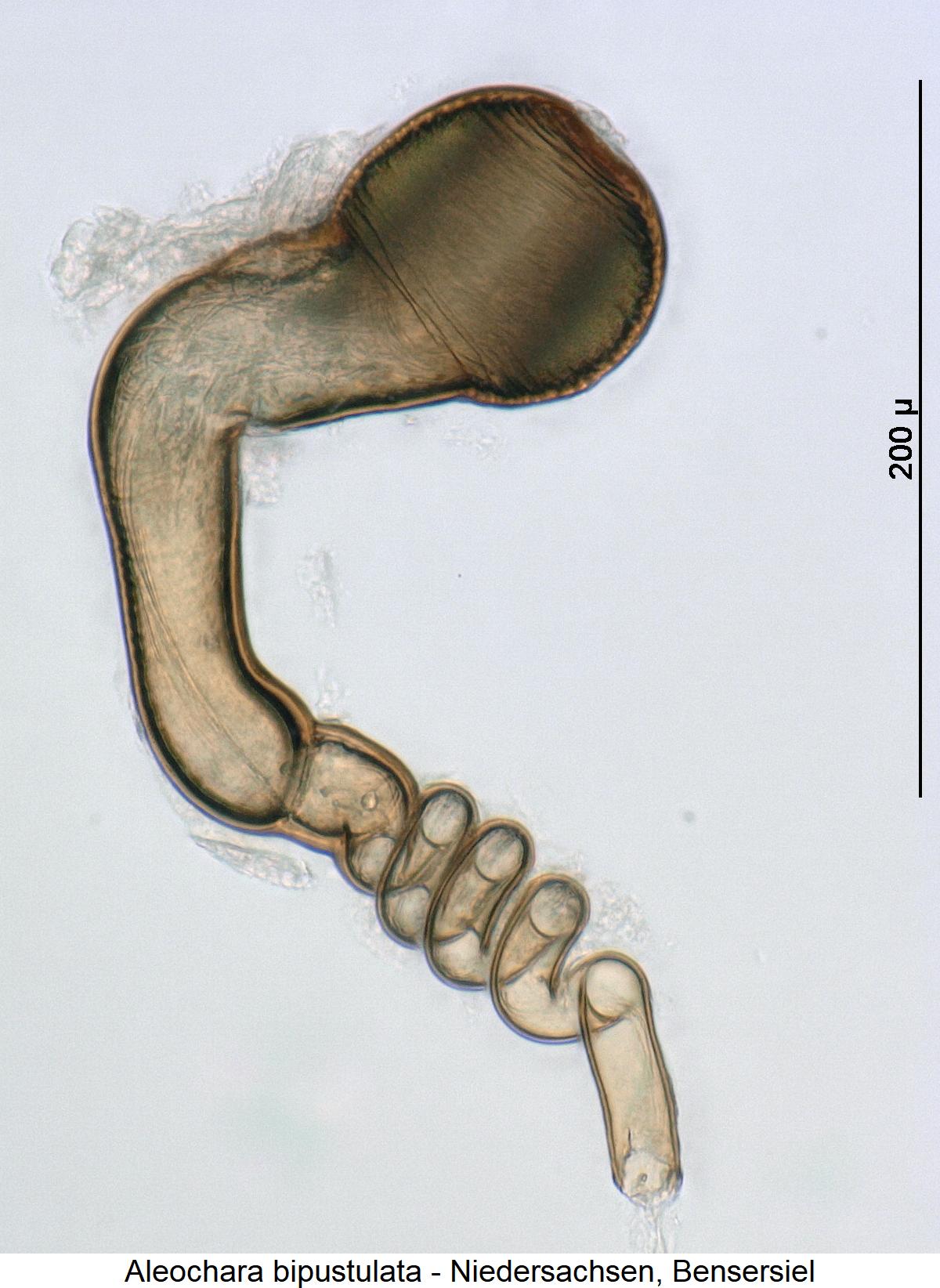 aleochara_bipustulata_sperm1.jpg