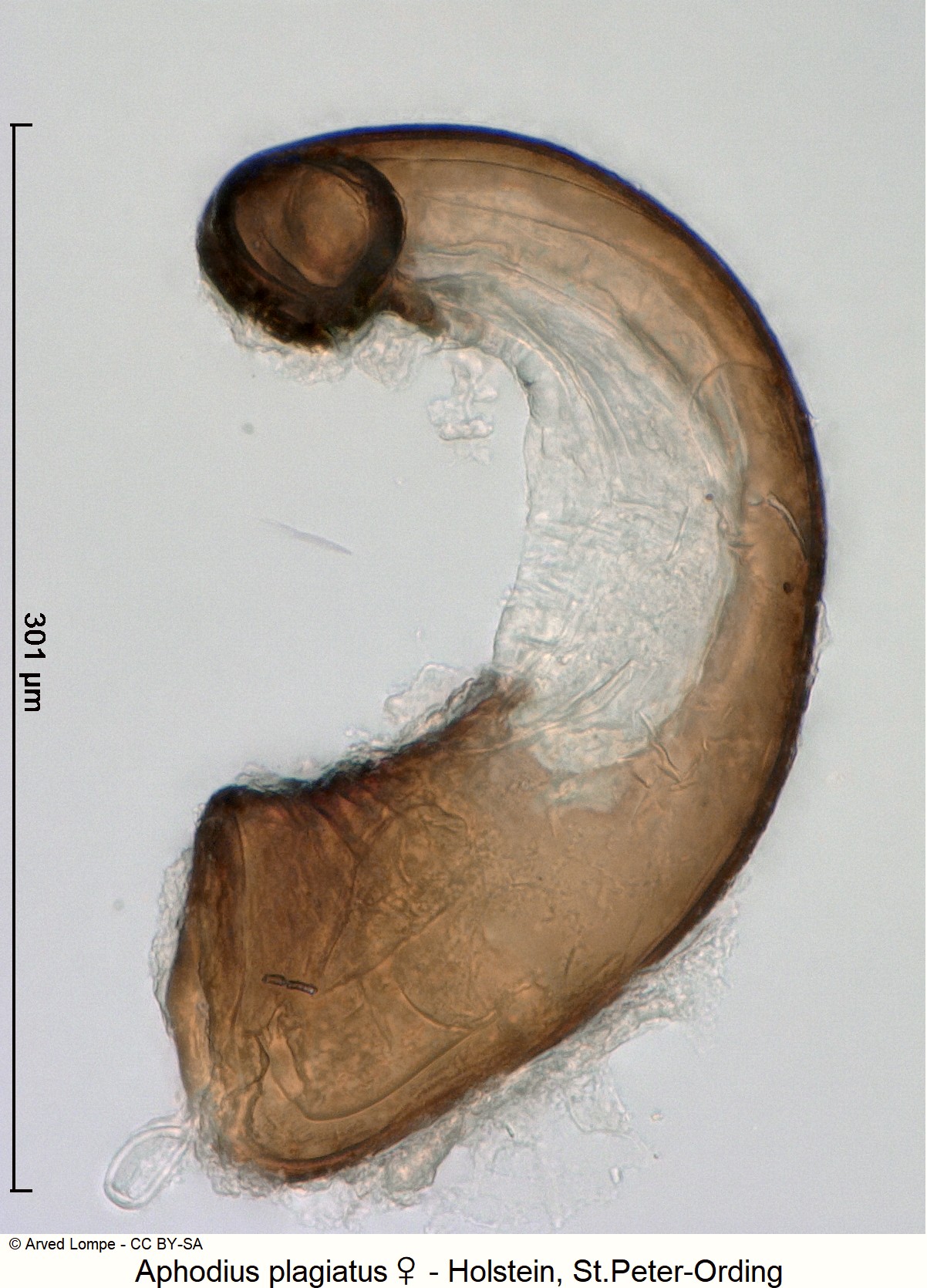 aphodius_plagiatus_w_ck10607_sperm.jpg