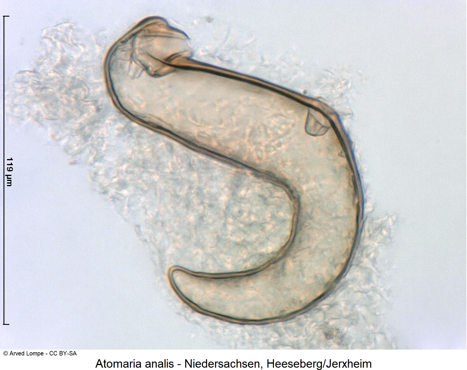atomaria_analis_ck31737623_sperm.jpg