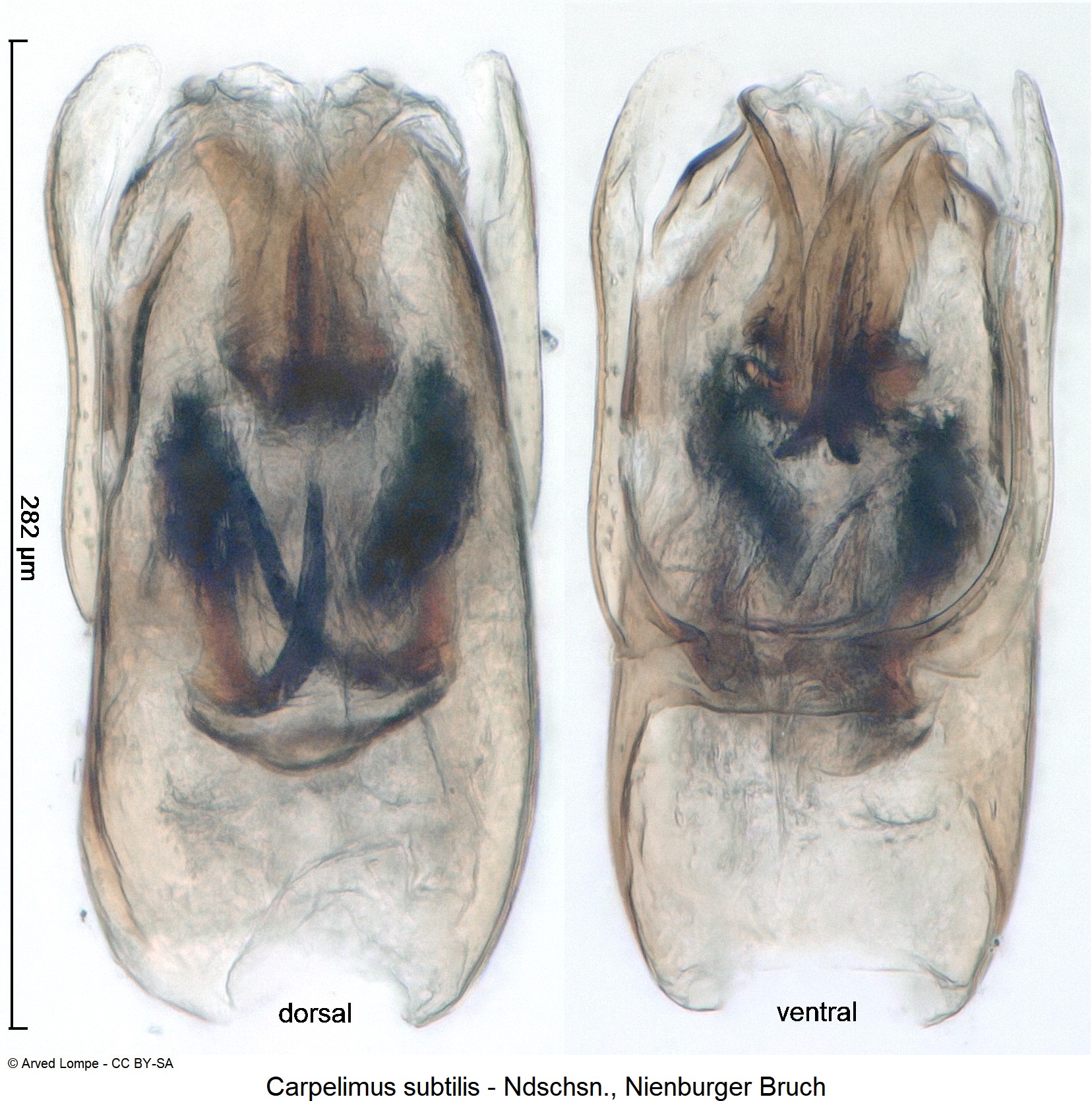 carpelimus_subtilis_ck35584816.jpg