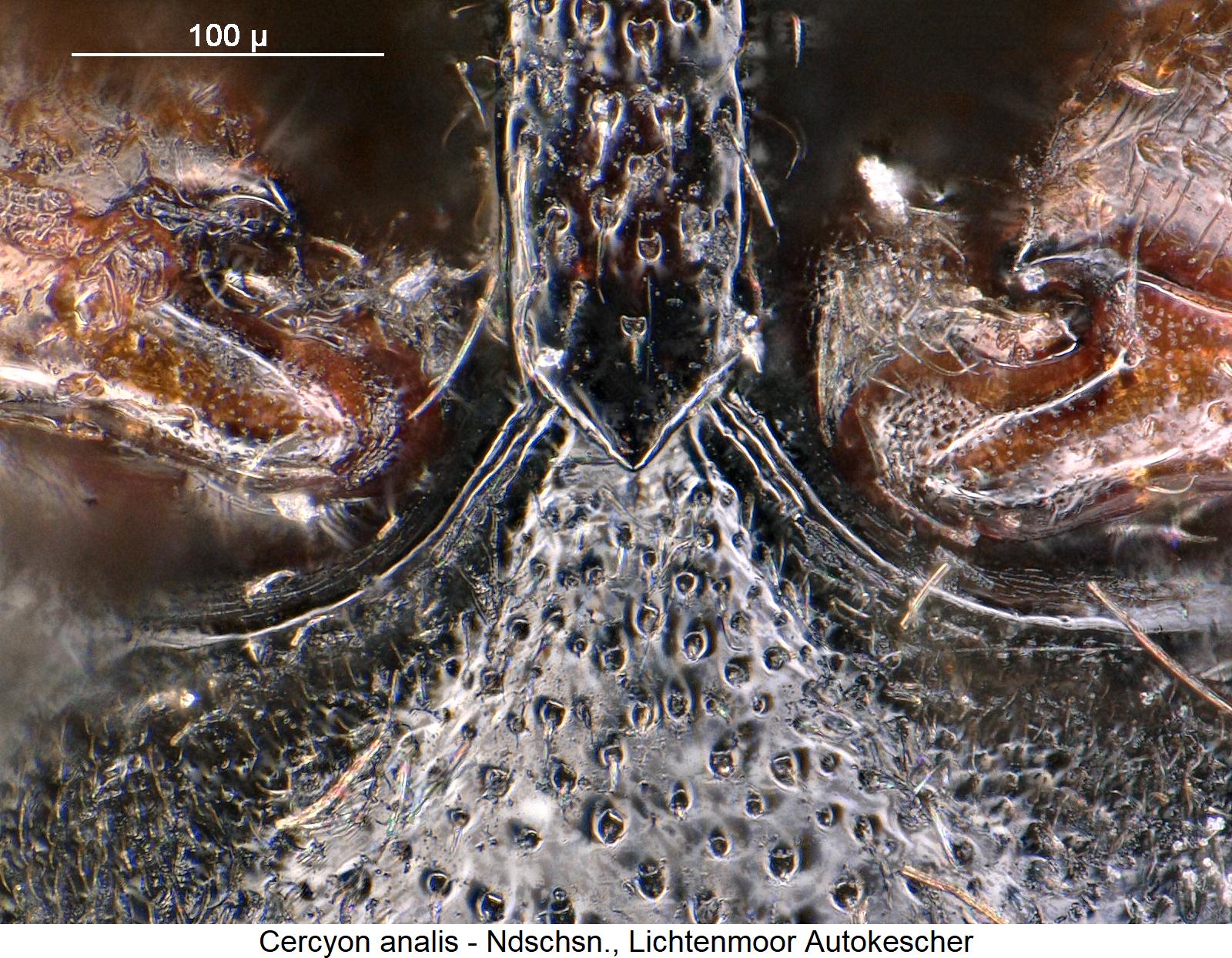 cercyon_analis_hbr.jpg