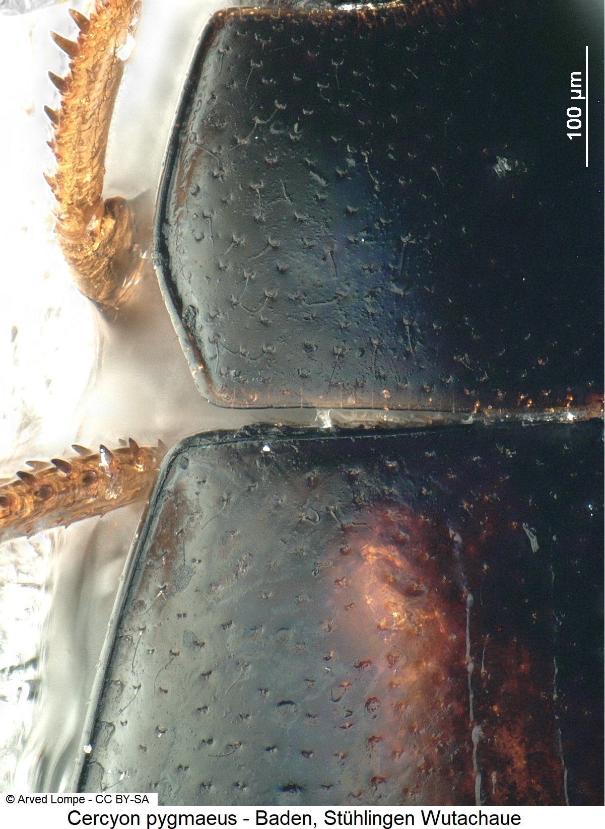 cercyon_pygmaeus_ck29356533_hsch_srd.jpg