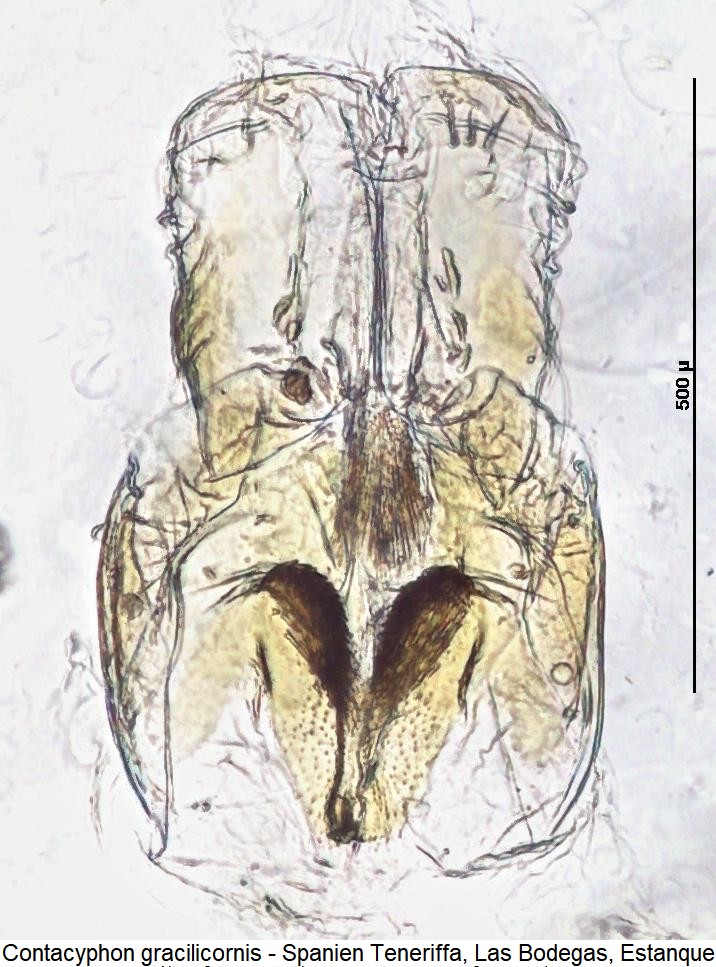 contacyphon_gracilicornis_bur1.jpg