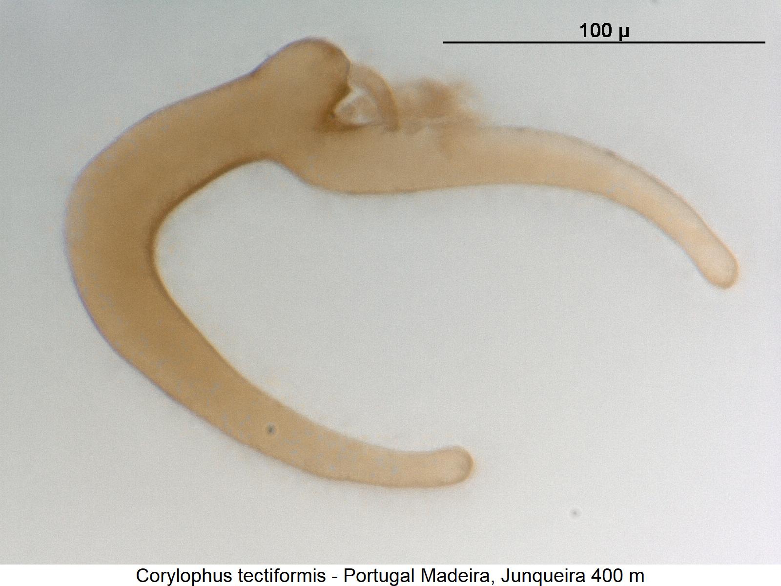 corylophus_tectiformis_sperm.jpg