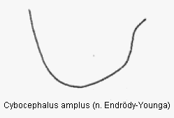 cybocephalus_amplus_hsch.gif