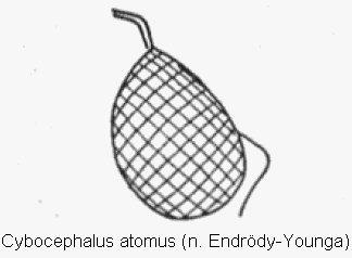 cybocephalus_atomus_k.gif
