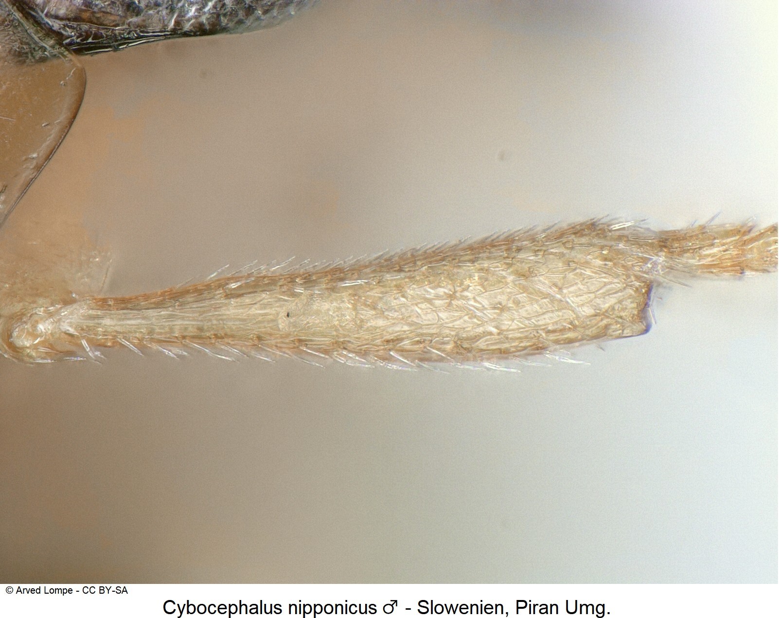 cybocephalus_nipponicus_m_vschn.jpg