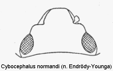 cybocephalus_normandi_k.gif