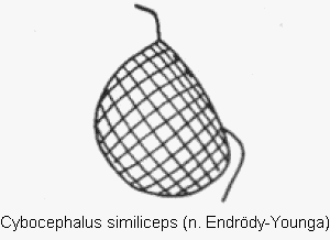 cybocephalus_similiceps_k.gif