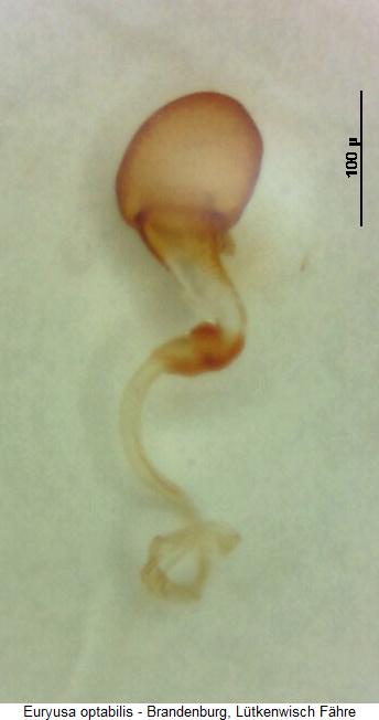euryusa_optabilis_sperm.jpg