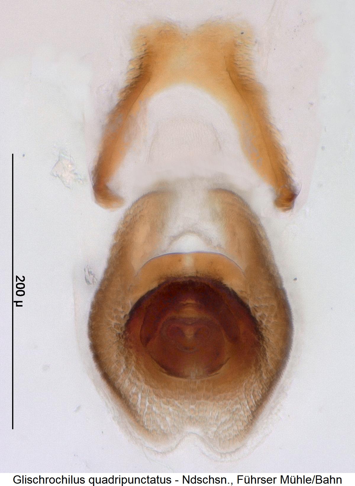 glischrochilus_quadripunctatus_pc.jpg