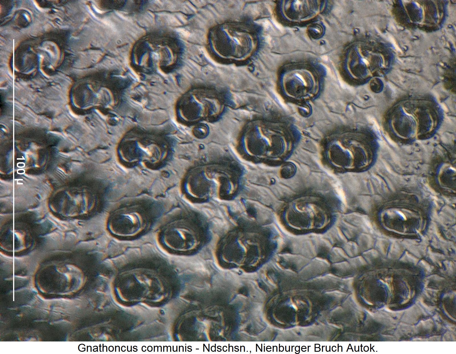 gnathoncus_communis_pyg.jpg