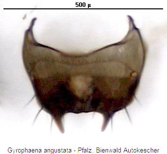 gyrophaena_angustata_tergit.jpg