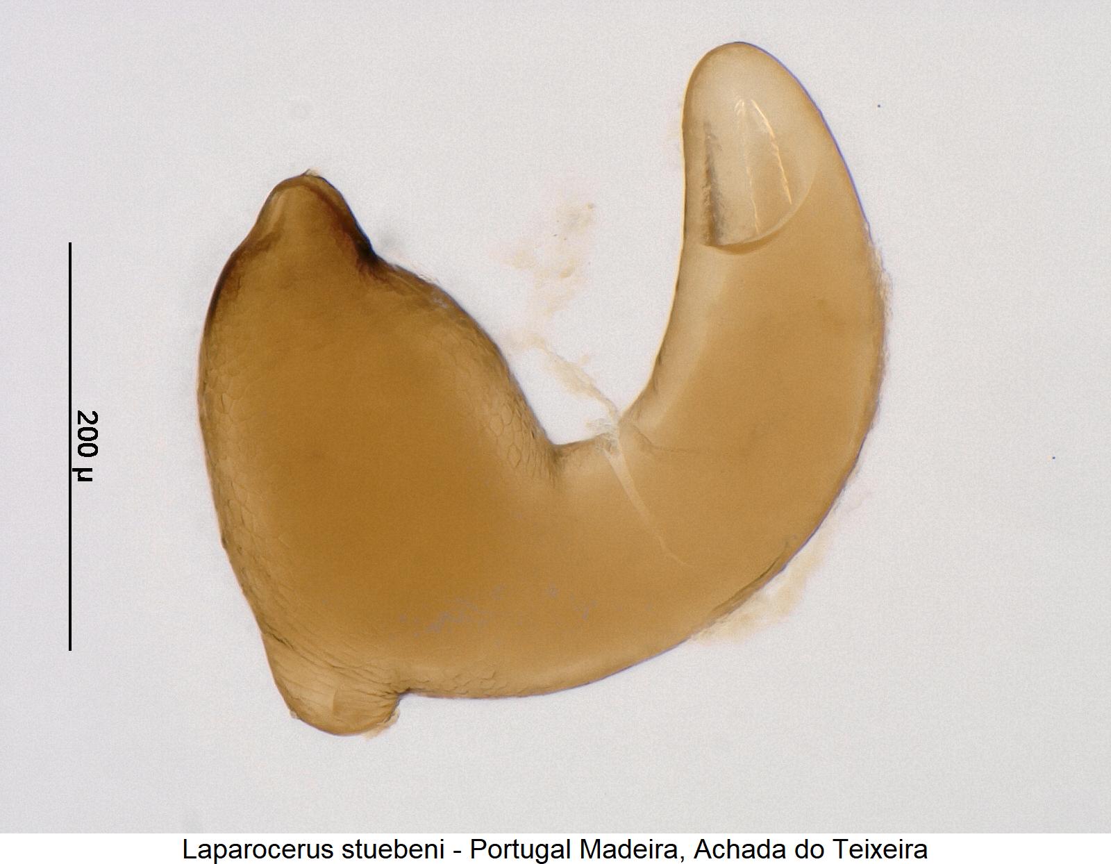 laparocerus_stuebeni_sperm.jpg