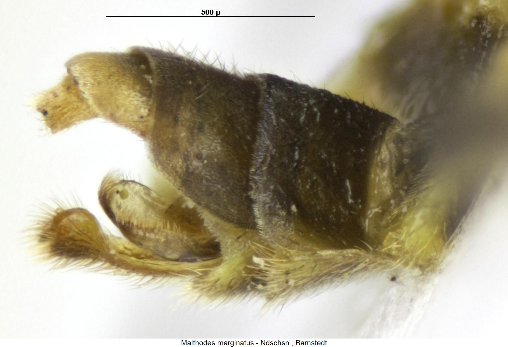 malthodes_marginatus_abd.jpg