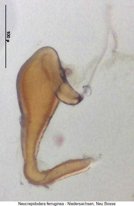 neocrepidodera_ferruginea_sperm.jpg