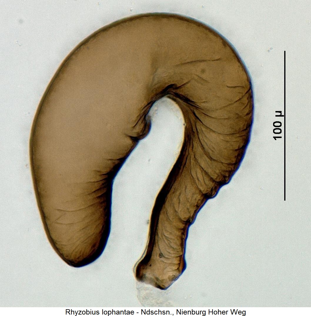 rhyzobius_lophantae_sperm.jpg