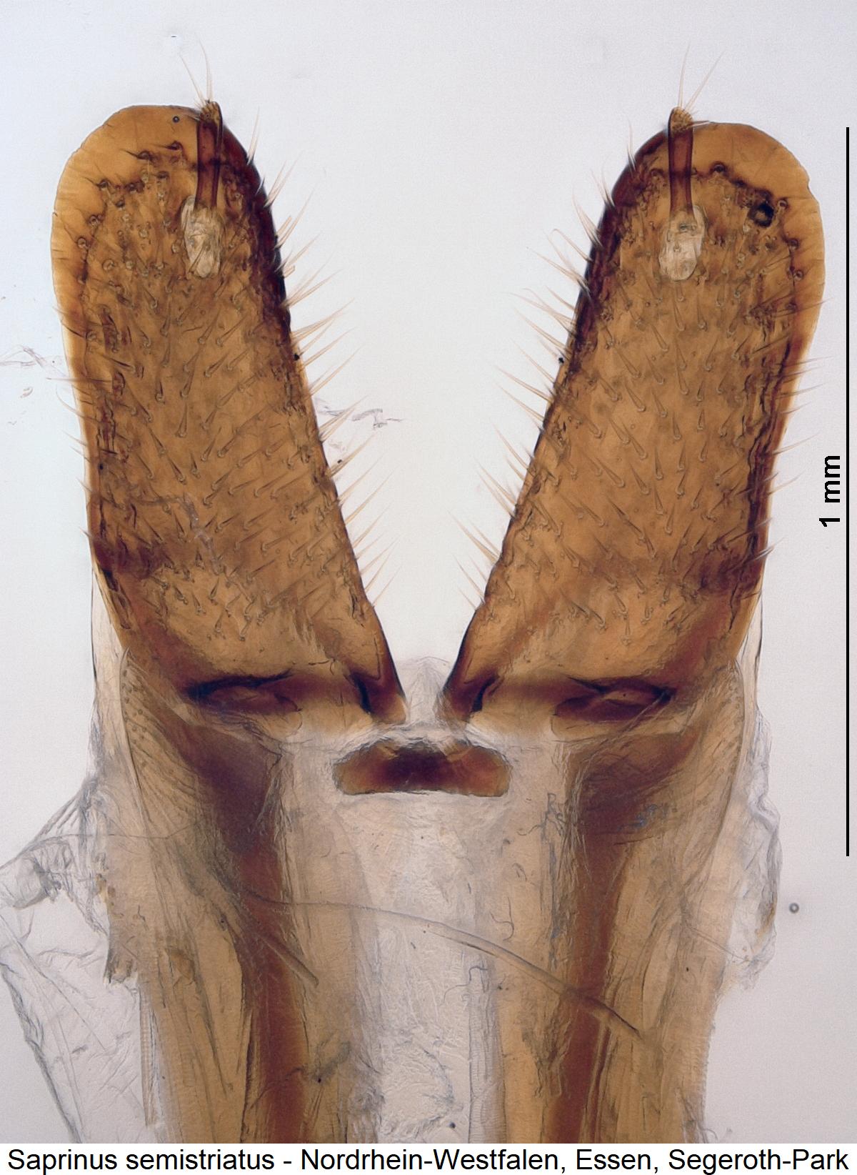 saprinus_semistriatus_ovi.jpg
