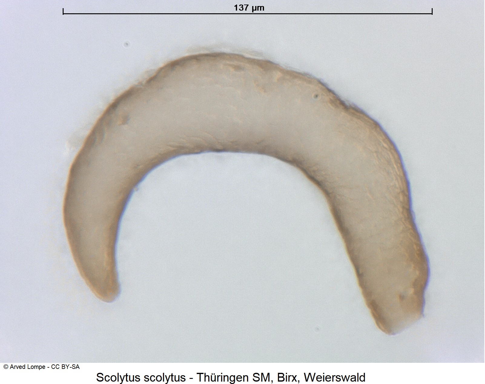scolytus_scolytus_ck32182147_sperm.jpg