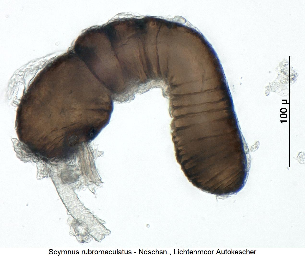 scymnus_rubromaculatus_sperm.jpg