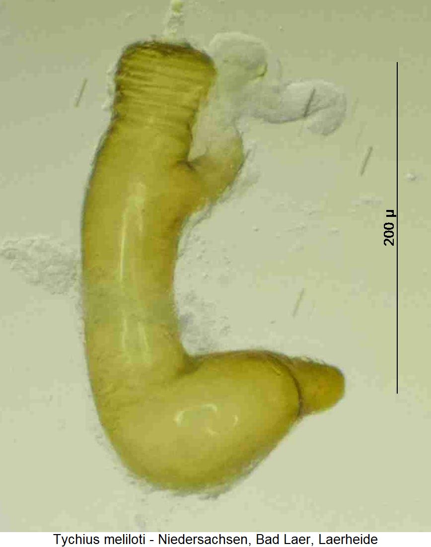 tychius_meliloti_sperm1.jpg