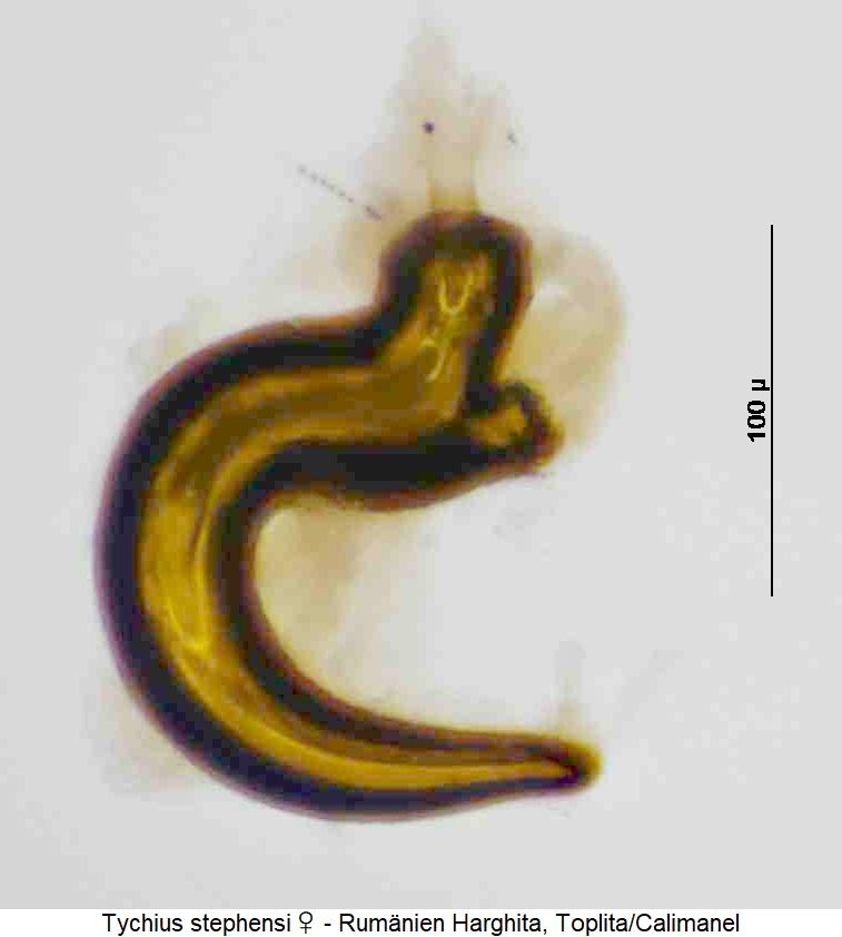 tychius_stephensi_sperm.jpg